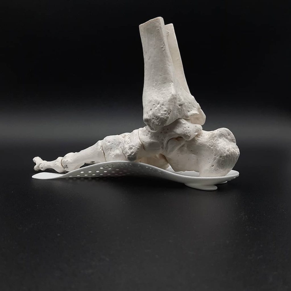 3D Insoles, plantillas 3D ortopédicas