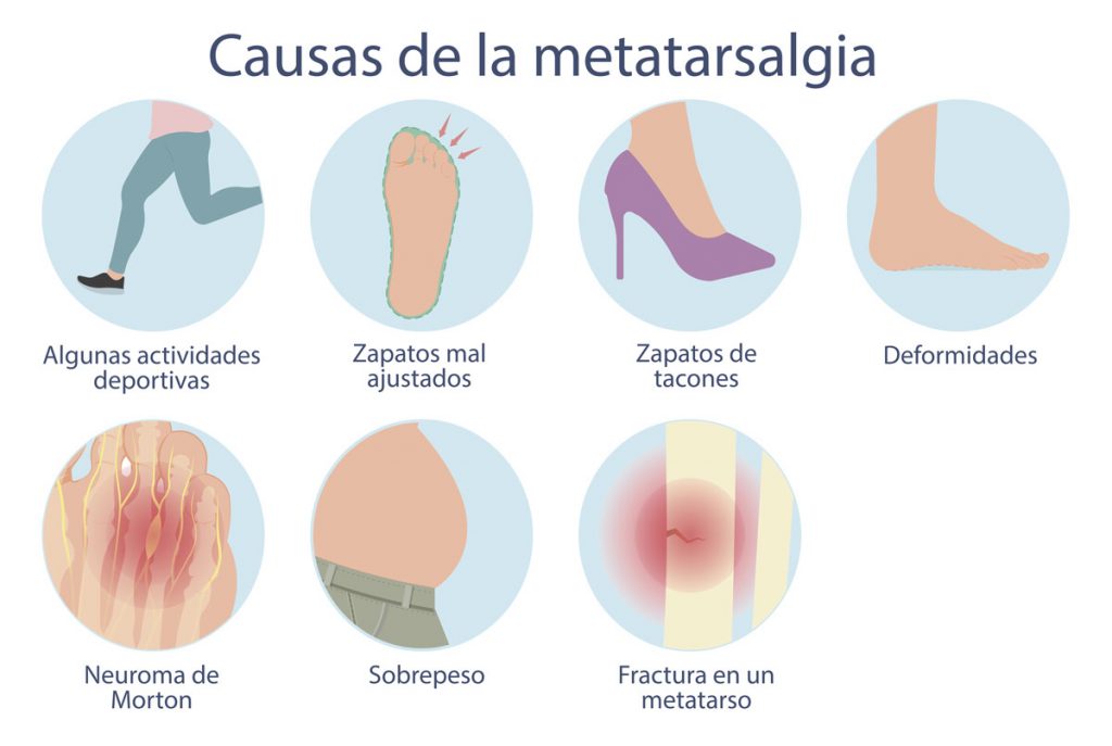 Causas metatarsalgia