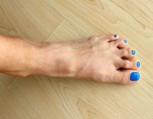 Esmalte de uñas daña las uñas del pie