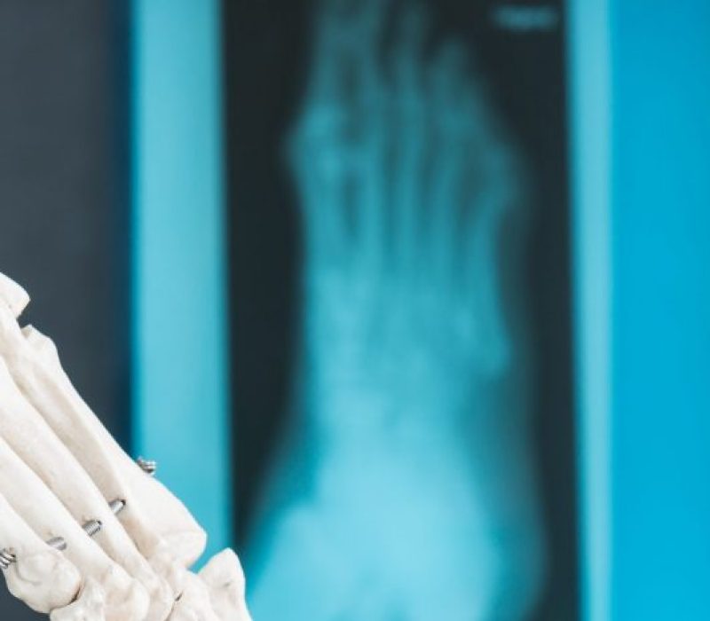 Estudios Biomecánicos en Barcelona