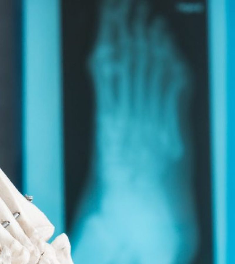 Estudios Biomecánicos en Barcelona