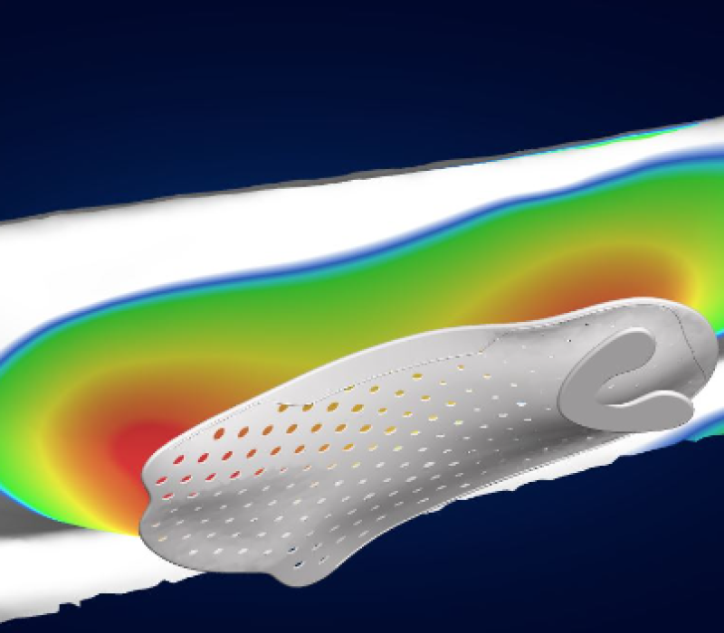 Plantillas 3d - Podología Barcelona